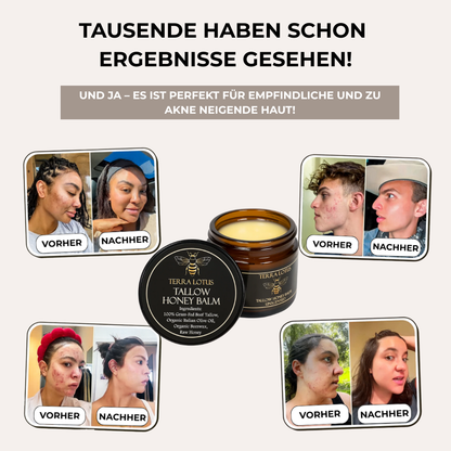 Tallow & Honey Balm – 60 ml